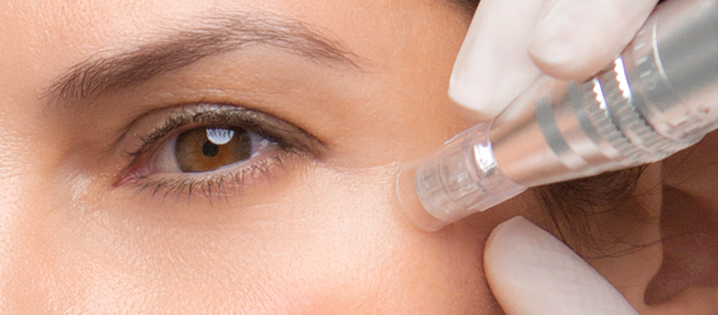 Microneedling under eyes: benefits & expert advice